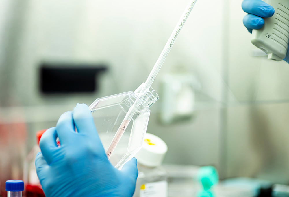 細胞検査　イメージ画像